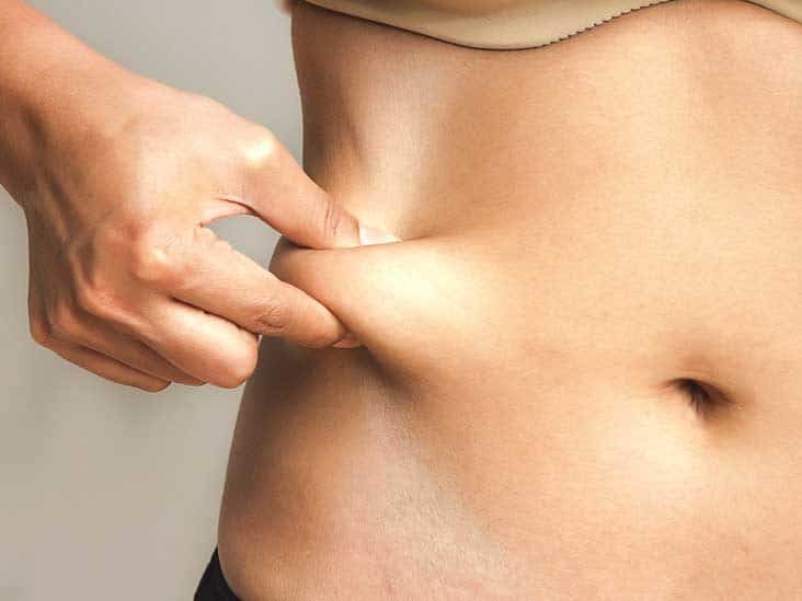 Stubborn Fat With CoolSculpting