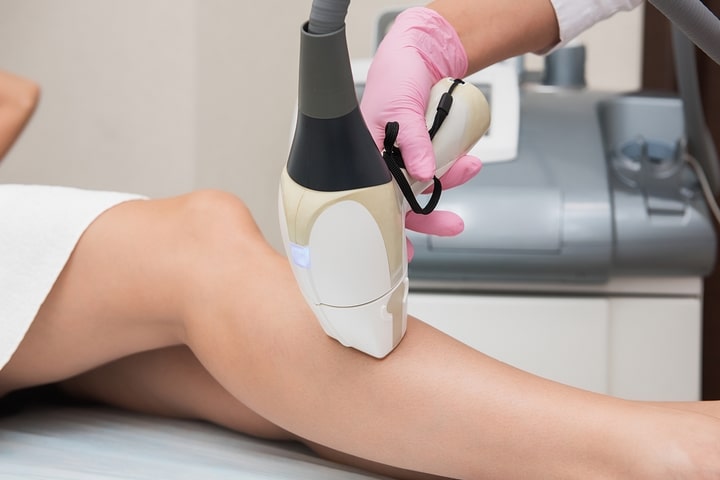 The Laser Hair Removal Process