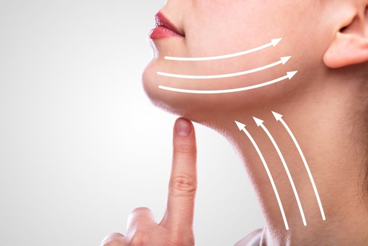 Kybella Reaction Or Treatment