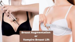 Breast Augmentation or Vampire Breast Lift