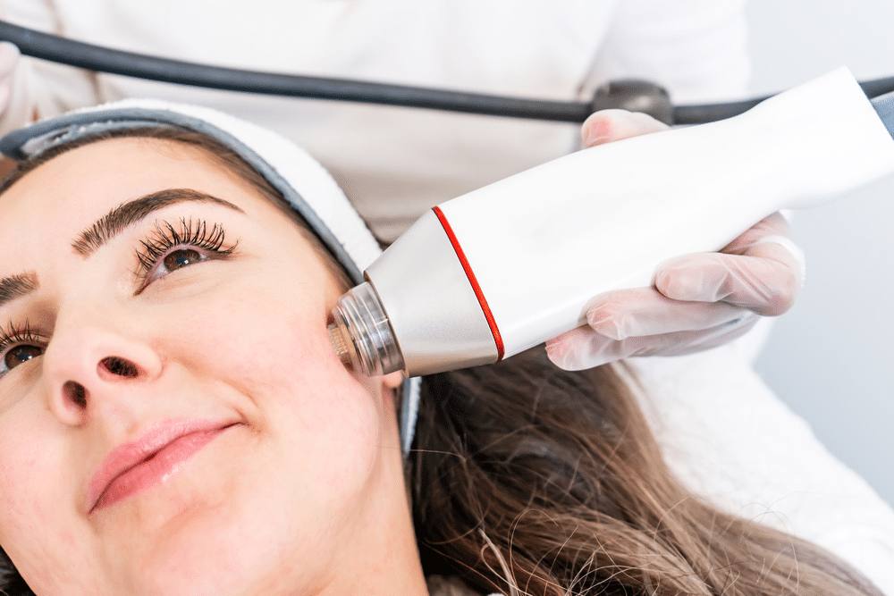 Micro-needling Aftercare