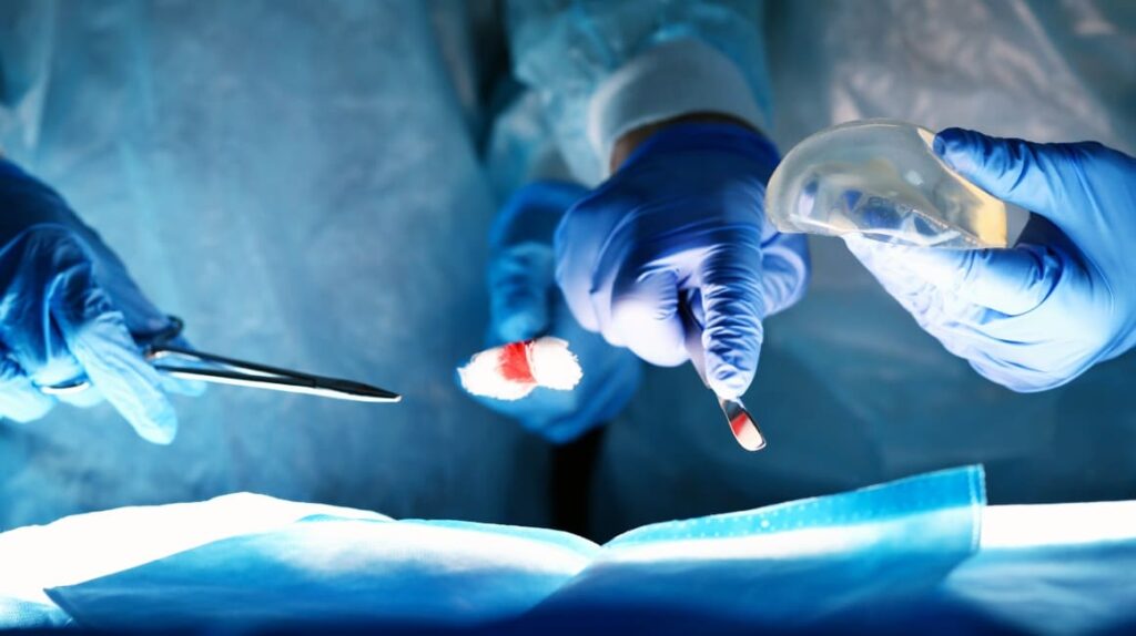 Liposuction Surgeon treatment