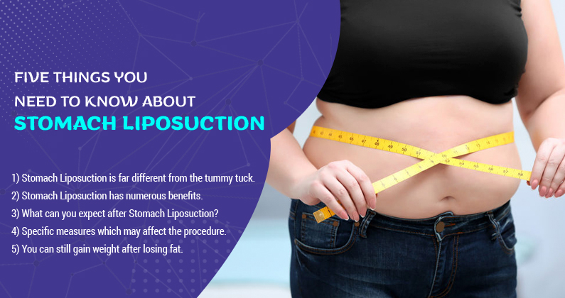 Everything You Need to Know About Liposuction