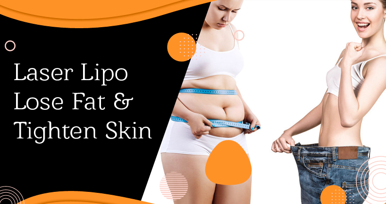 Laser-Lipo-Lose-fat-and-tighten-skin