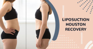 Liposuction-Houston-Recovery
