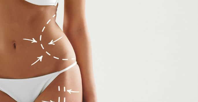 About Stomach Liposuction