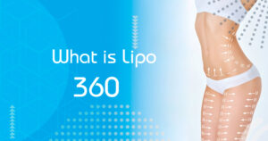 What-is-Lipo-360