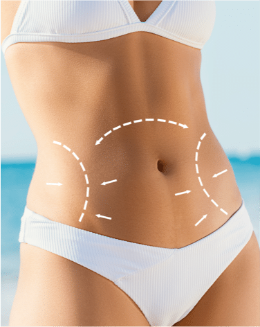 Liposuction: Benefits