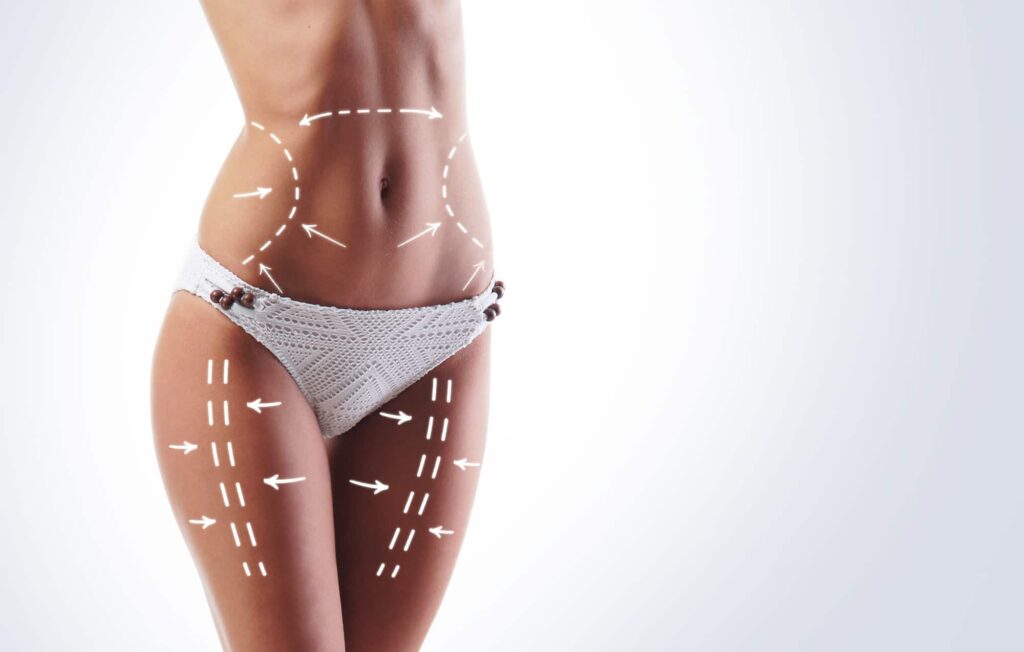 Risks of liposuction