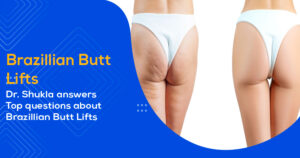 BBL-Brazilian-Butt-Lift
