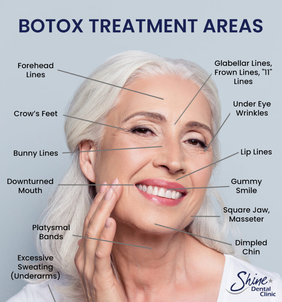 Is it safe to have Botox skin treatment frequently?
