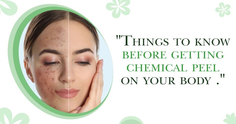 Things-to-know-before-getting-chemical-peel-on-your-body