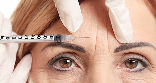 What is it like to get Botox Injections