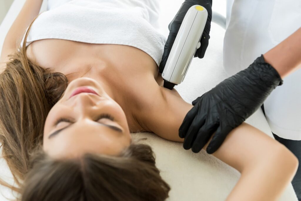 laser hair removal on armpits