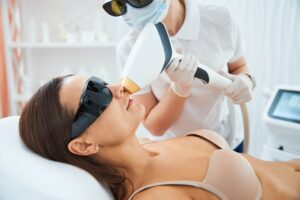 PATIENT getting an upper lip laser hair removal