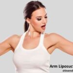 Arm Liposuction Treatment
