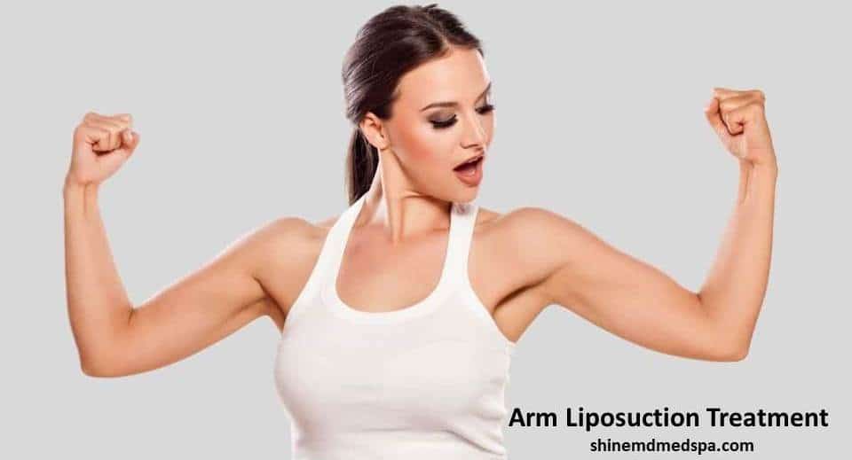 Arm Liposuction Treatment