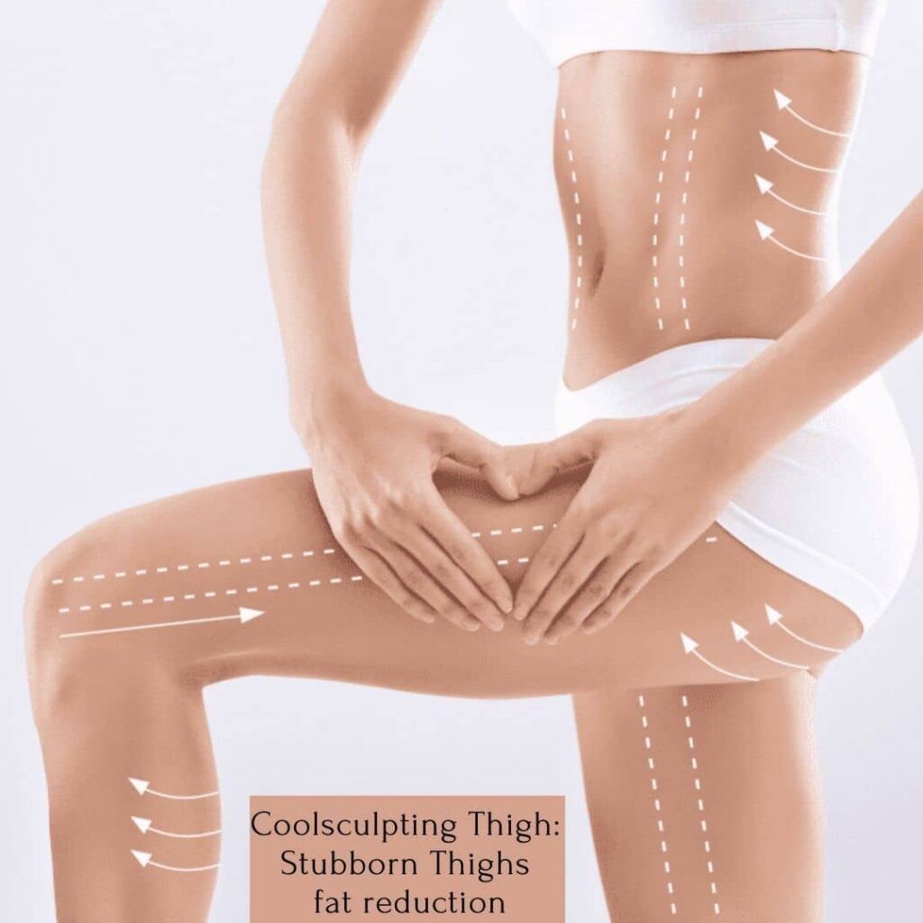 Coolsculpting Thigh Stubborn Thighs fat reduction (1)
