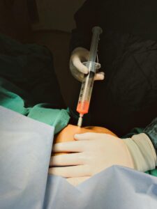 Surgeon's hand using a cannula for liposuction